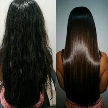 Antes e Depois